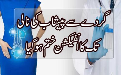 Gurde Se Peshab Ki Nali Ka Infection