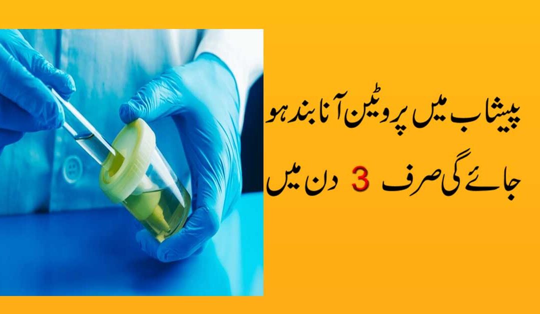 Peshab Mein Protein Se Shifa Ka Taweez