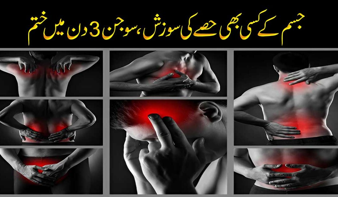 Jism K Kisi Bhi Hissay Me Sujan/Sozish Ka Ilaj
