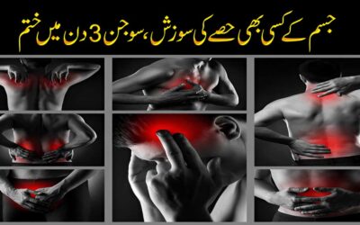 Jism K Kisi Bhi Hissay Me Sujan/Sozish Ka Ilaj