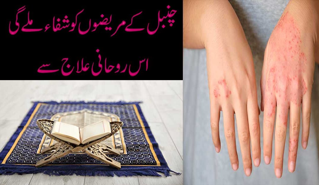 Chamabal Ke Mareezon Ka Ilaj Aur Taweez