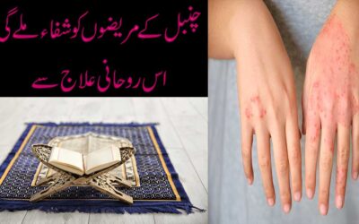Chamabal Ke Mareezon Ka Ilaj