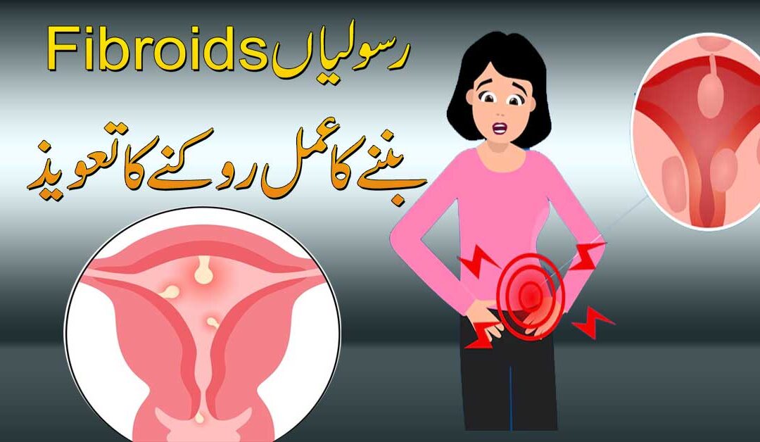 This Surah Removes Fibroids Fast