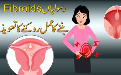 Fibroid K Liye Powerful Taweez