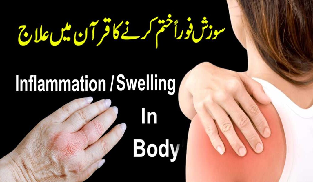 Sozish Foran Khatam Karne Ka Quran Mein Ilaj