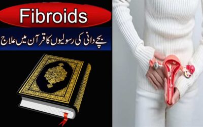 Uterine Fibroids Treatment In Quran