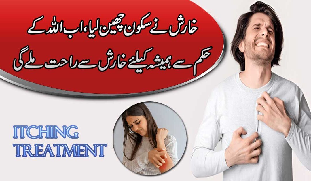 Kharish (Itch) Ka Rohani Ilaj