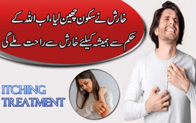 Kharish (Itch) Ka Rohani Ilaj